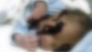 Diabetic Complications:Choose these complications of diabetes or a change in lifestyle