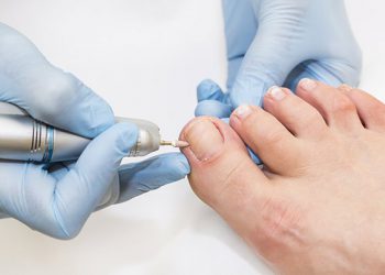 Diabetic feet | The need for proper diabetic foot care.