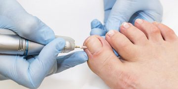 Diabetic feet | The need for proper diabetic foot care.