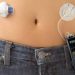 The Diabetic Pump – For a Healthier Lifestyle