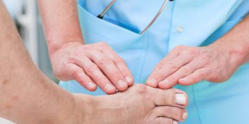 Simple Diabetic Foot Care Tips