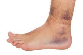Diabetic foot problems and tips to deal with the diabetic feet