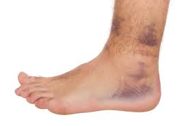 Diabetic foot problems and tips to deal with the diabetic feet